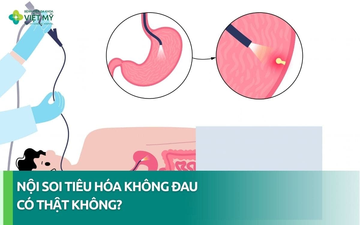 Nội soi tiêu hóa không đau là gì? Ưu điểm và quy trình thế nào?
