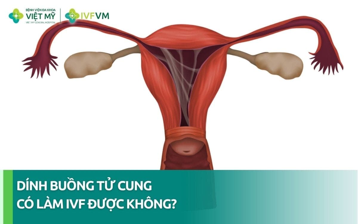 Phụ nữ dính buồng tử cung có làm IVF được không?