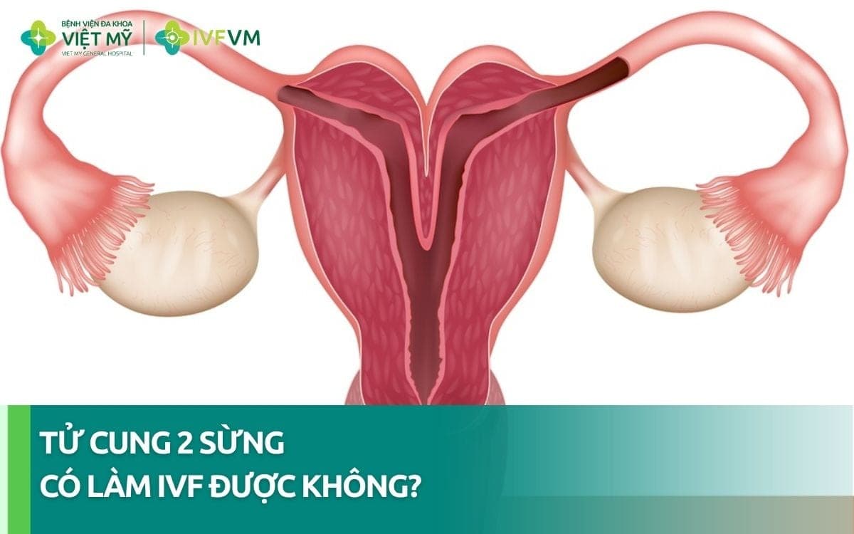 Phụ nữ bị tử cung 2 sừng có làm IVF được không?